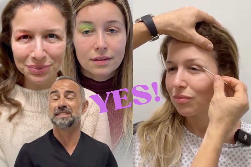 Dr Bernardini eye transformation