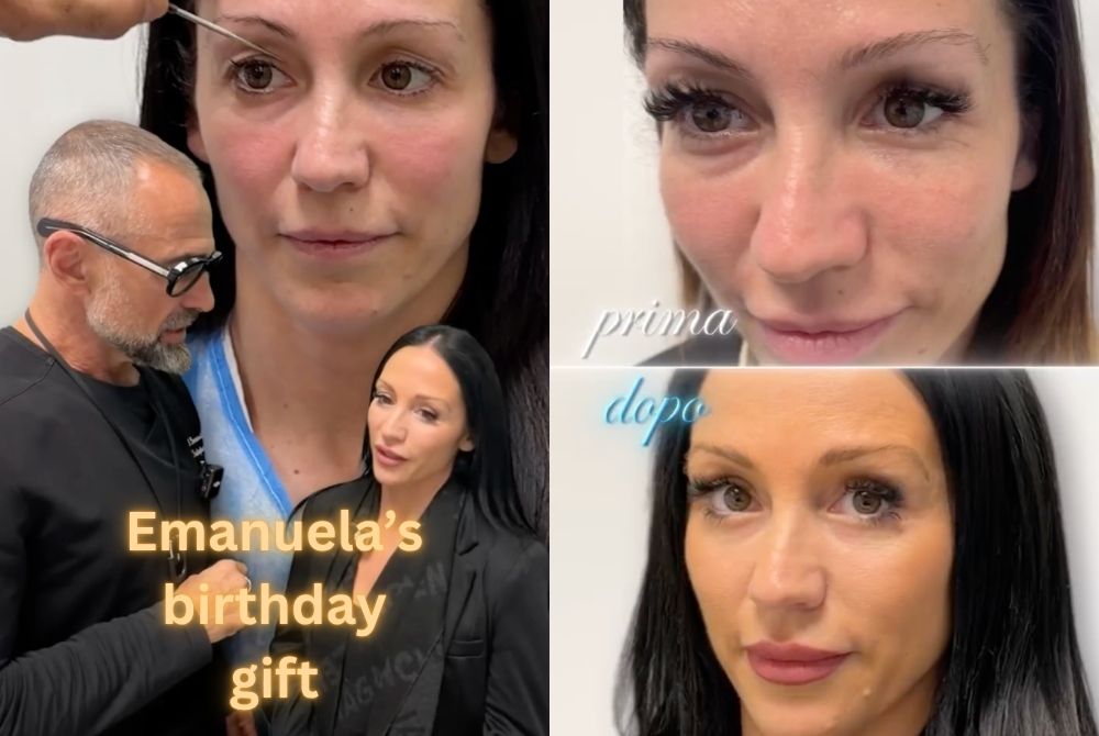 complete blepharoplasty lipofilling
