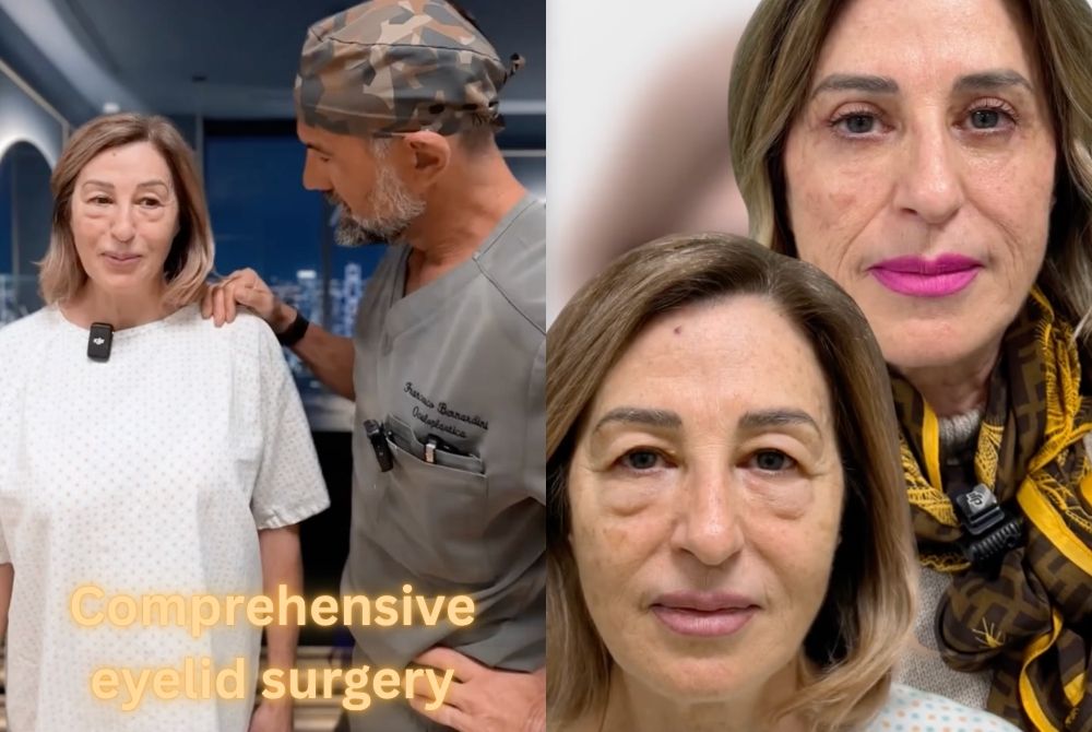 comprehensive eyelid surgery results