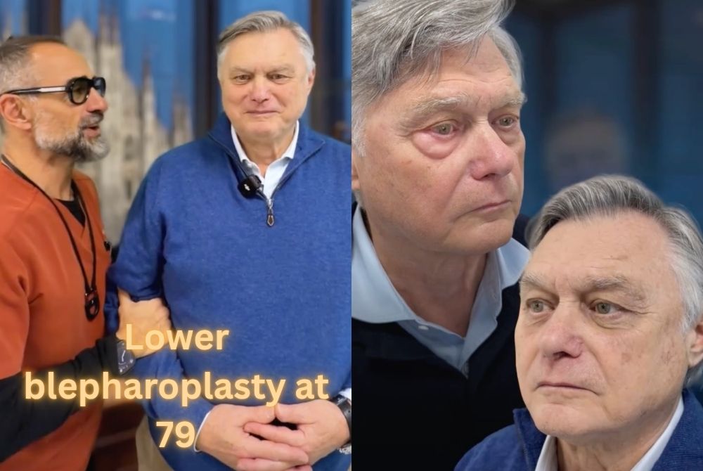 scarless lower blepharoplasty