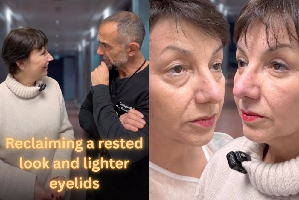 upper lower blepharoplasty rested look