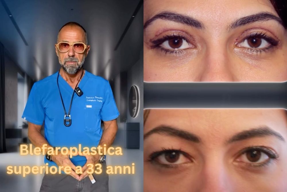 blefaroplastica superiore asimmetria 33 anni blefaroplastica superiore asimmetria 33 anni