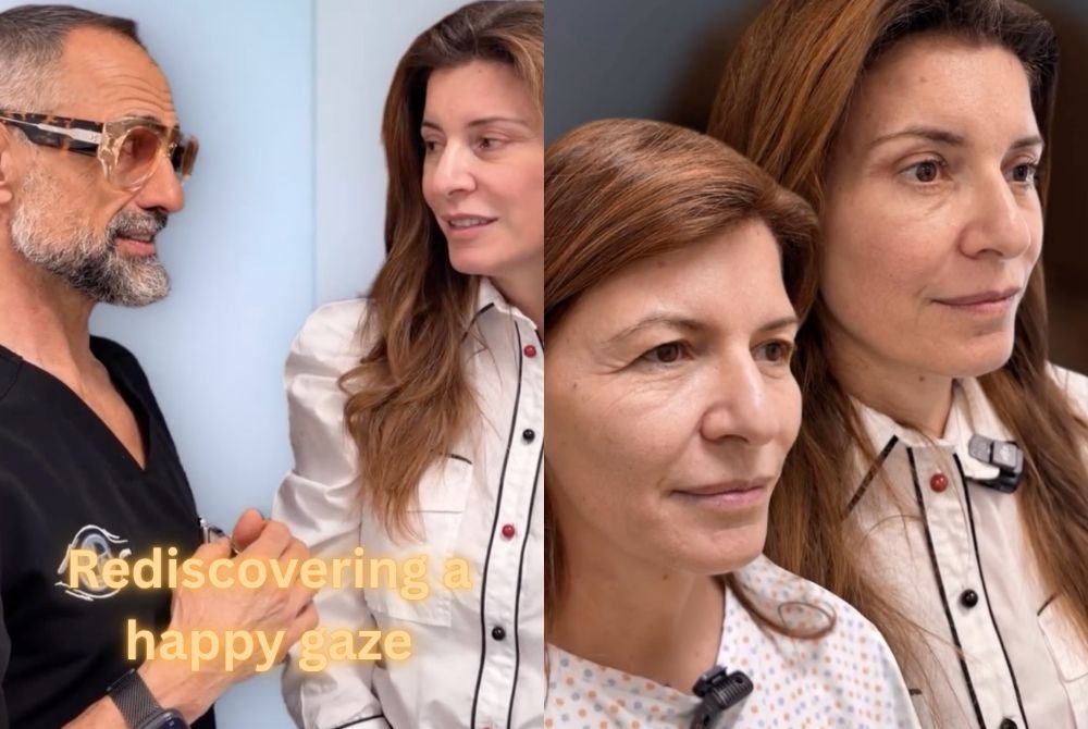 endoscopic facelift blepharoplasty