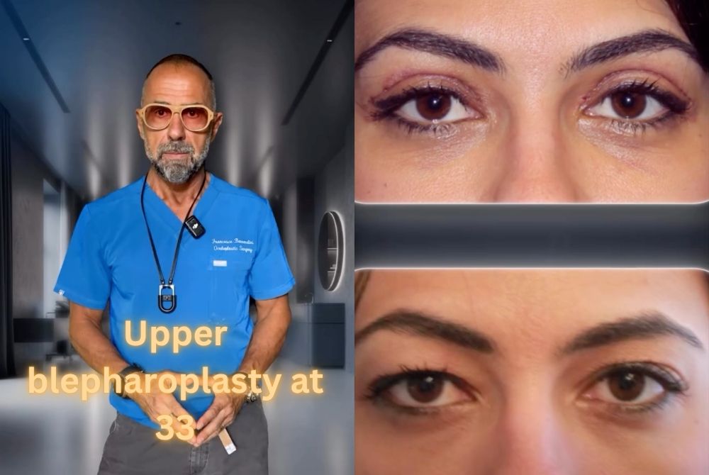 upper blepharoplasty asymmetry 33 years old