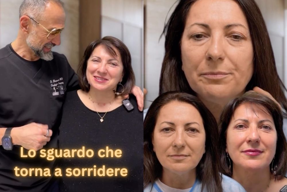 caso clinico blefaroplastica combinata caso clinico blefaroplastica combinata