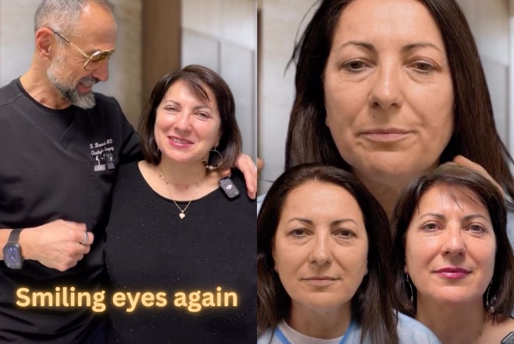 combined blepharoplasty clinical case