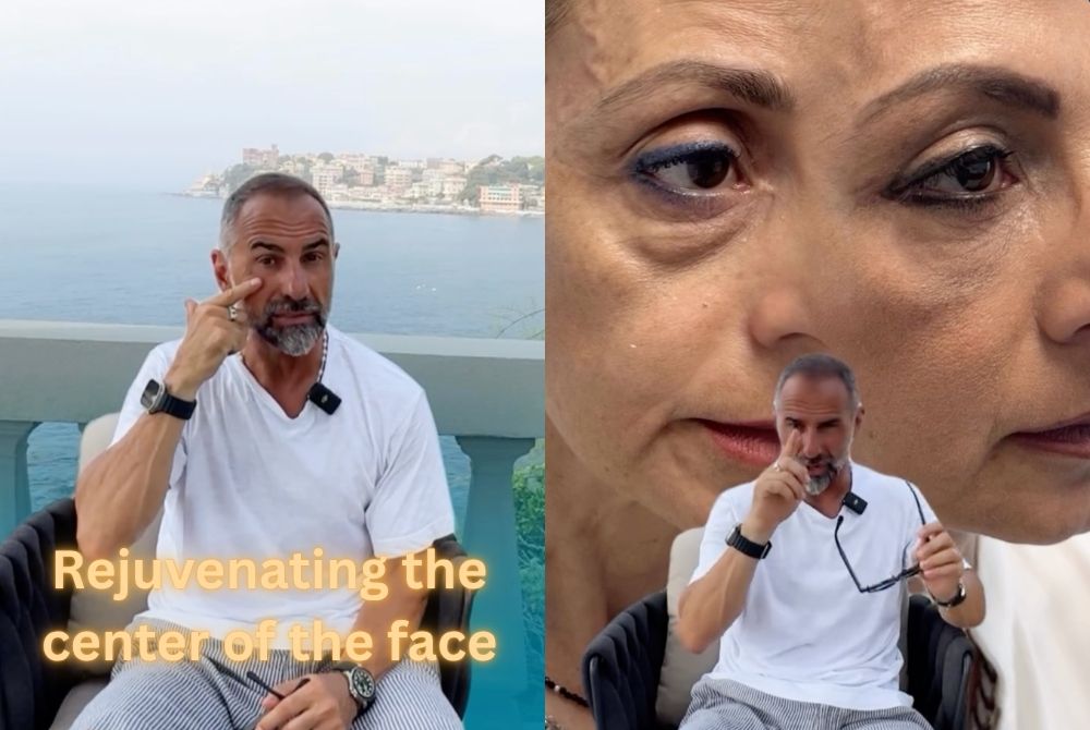 midface rejuvenation lower blepharoplasty